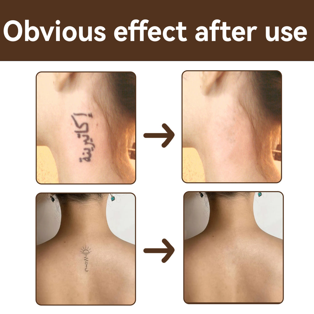 Tattoo Concealer Scar Birthmark Spot Waterproof